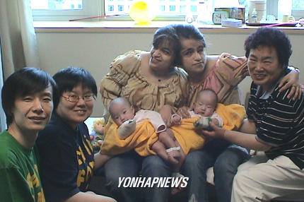 한국 샴쌍둥이 가족