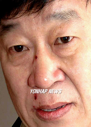 상처입은 현대차 사장