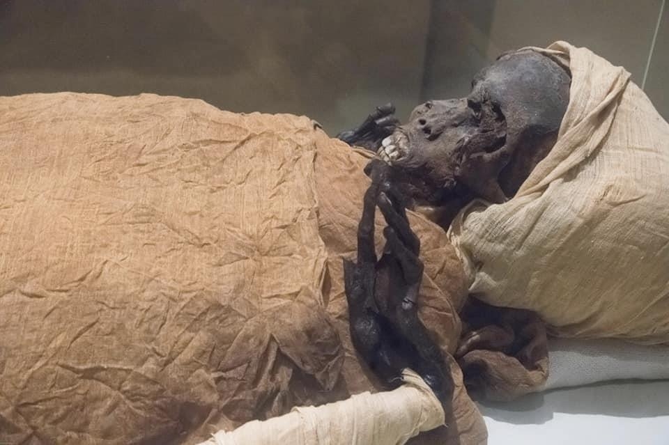 의학기술로 재구성한 3천600년전 이집트 파라오의 죽음