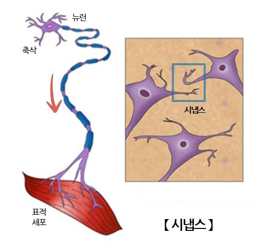 치매 위험 예측 새로운 뇌 단백질 발견