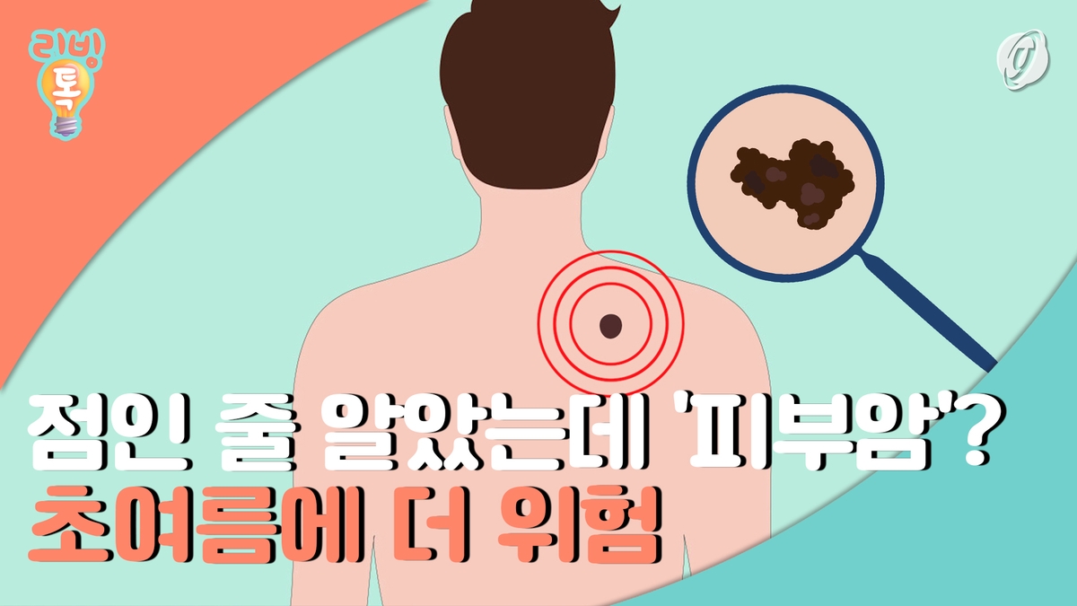 [리빙톡] 점인 줄 알았는데 피부암?…초여름에 더 위험