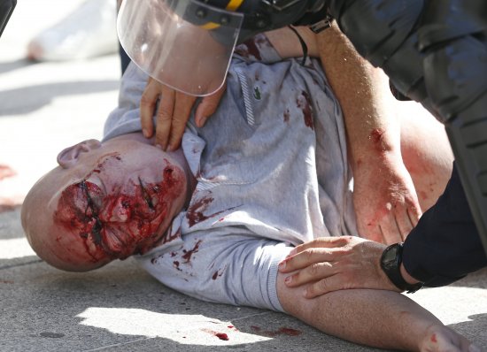 [포착]유혈 낭자한 프랑스 시민 왜?