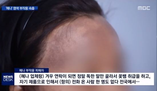 헤나 제조사가 염색 후 얼굴 까매진 소비자에게 보인 반응