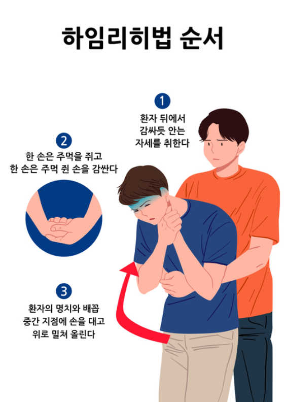 송편 먹다 목에 걸려 켁켁…하임리히법 이렇게 목숨 구한다