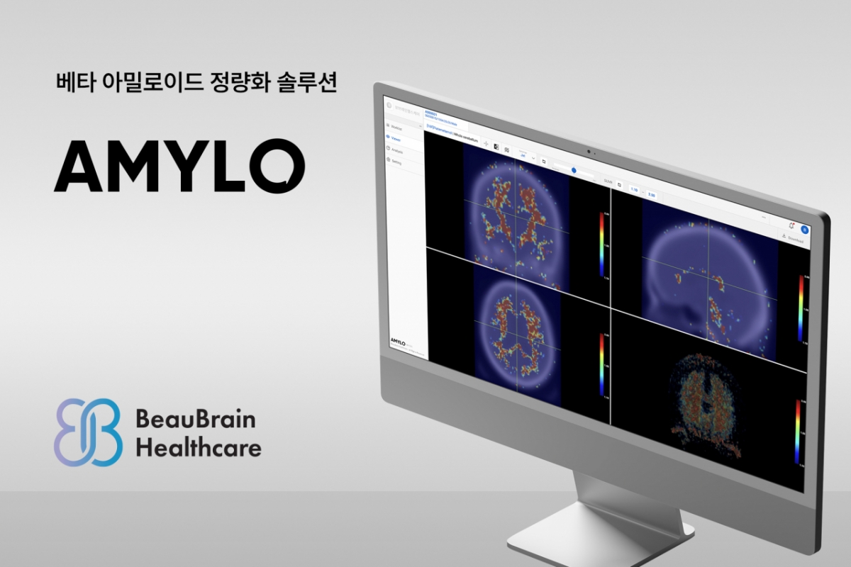 뷰브레인헬스케어, 대한치매학회 국제학술대회 참가
