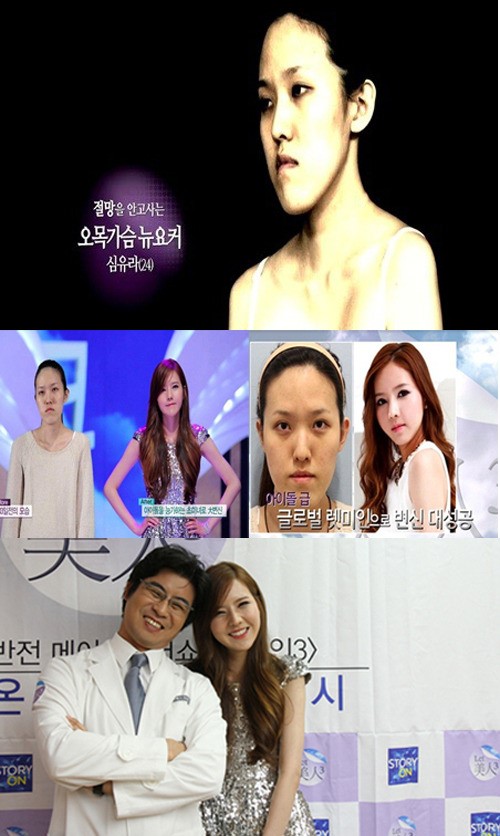 ‘렛미인3’ 국제 왕따 오목 가슴녀, “제시카 닮은 얼굴로 변신”