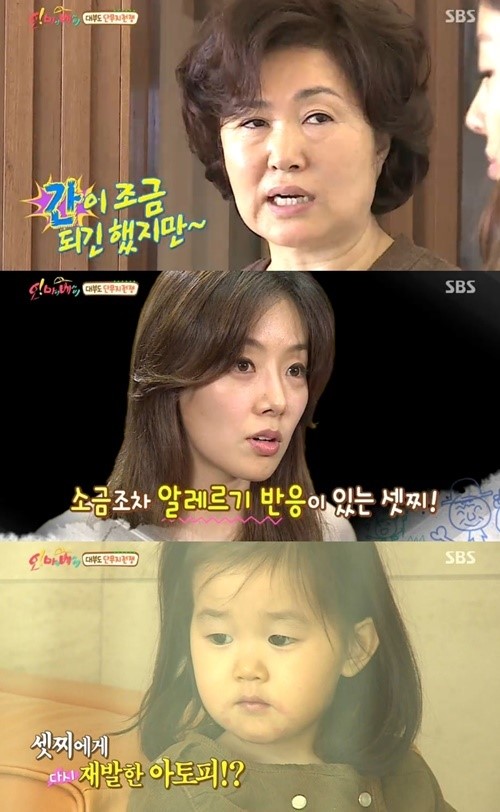 ‘오마베’ 이은, 단무지 먹은 딸에 급히 아토피 비상약 처방