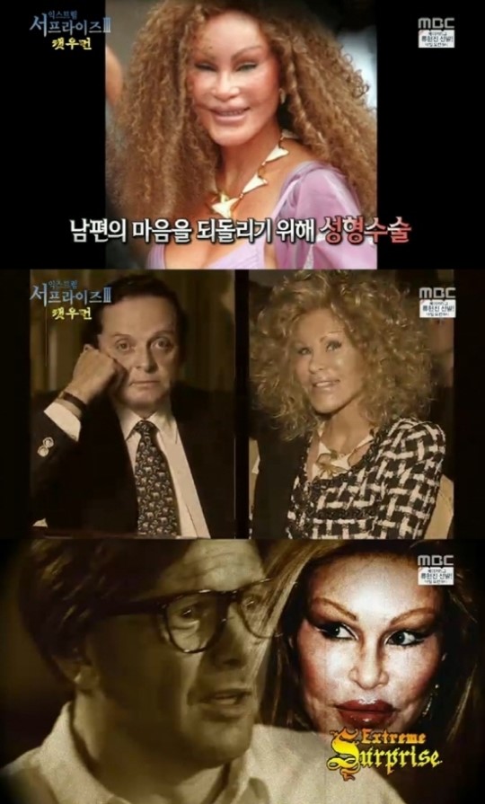 `서프라이즈` 조슬린 와일든스타인, 고양이 얼굴로 성형 40억…이유는?