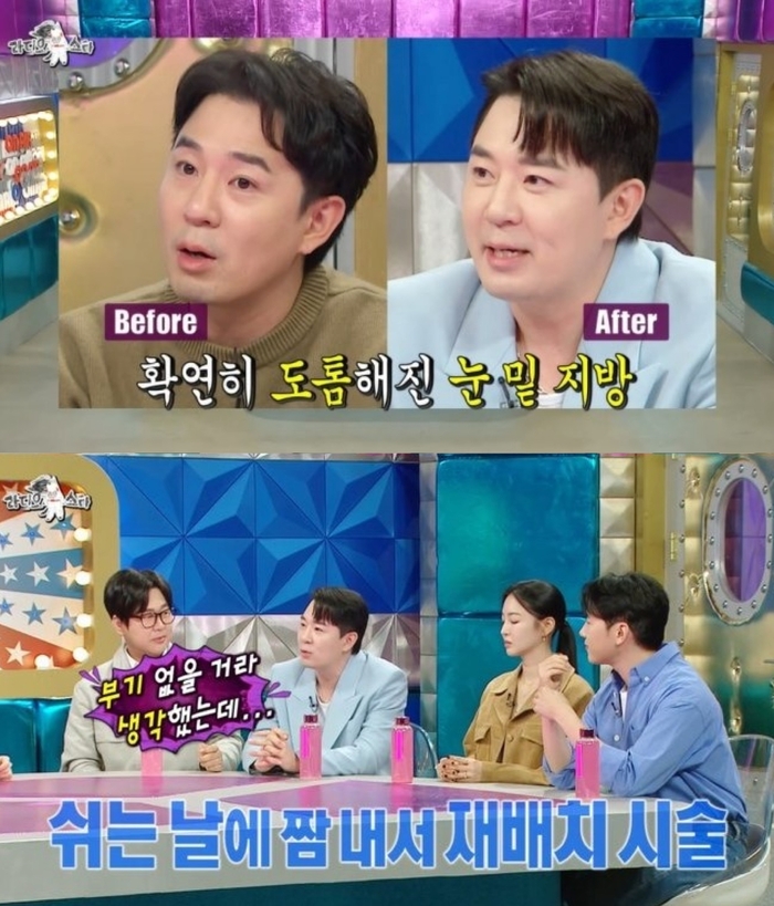붐, 성형 고백 “최근 눈밑지방재배치, 코 재수술은 NO” (‘라스’)