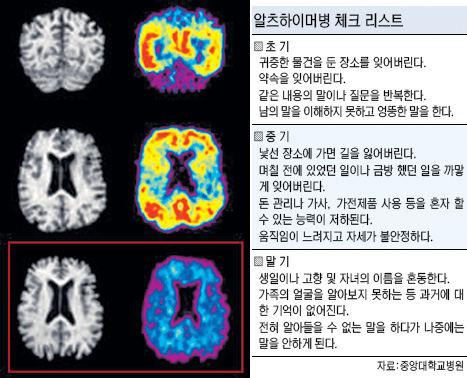 고혈압·당뇨 방치하면 치매 위험