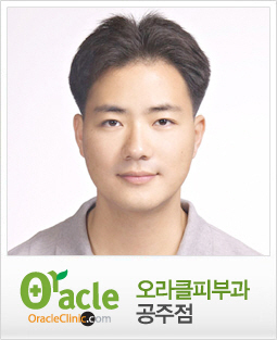 꽃가루 날리는 계절 여드름 퇴치 대작전, 프락셀 레이저 시술