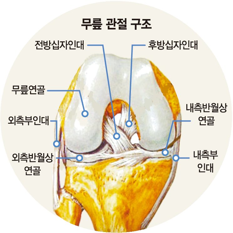 축구선수 단골 부상 전방 십자인대 파열… 재건술로 복귀 돕는다 [Weekend 헬스]