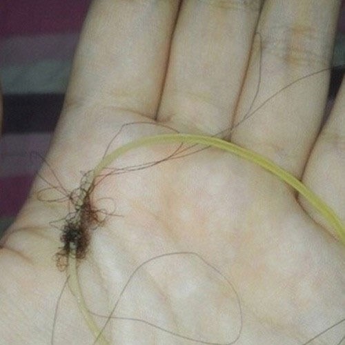 여자들만 아는 아픔, 사진만 봐도 두피가 뻐근~