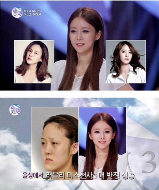 렛미인 방미정, 가장 예뻐진 순위 1위에…렛미인 최고미녀 영예