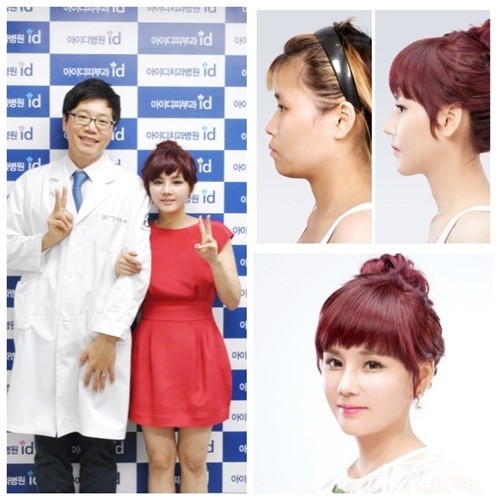 렛미인 배소영, 유재석급 ‘입매’ 잡아준 설측교정