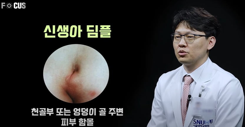 천사의 실수라는 보조개…여기 생기면 질환의 징조? [건강!톡]