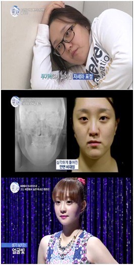 ‘렛미인4 의부증비만아내 김진, 만화를 찢고 나와 겨울왕국 엘사로 변신