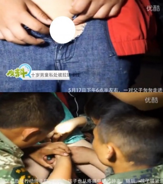 10세 소년 “바지 지퍼 올리다 성기가…” 화들짝