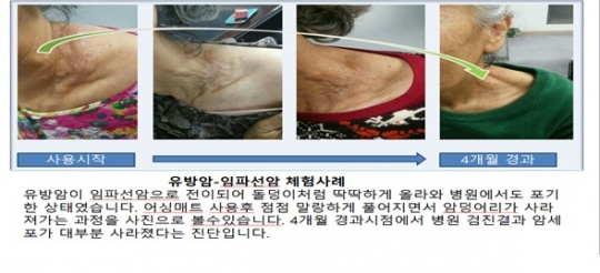 만병통치 침구로 속여 판 불법다단계 조직 7명 입건