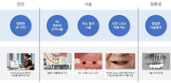 [제약바이오 스페셜] 디오, 디지털임플란트 앞세워 미국에서 고성장