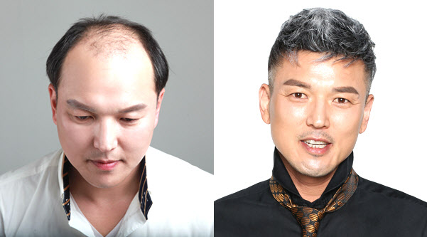 헤어증모술 전문 브랜드 거무타, 헤어증모 이벤트 진행