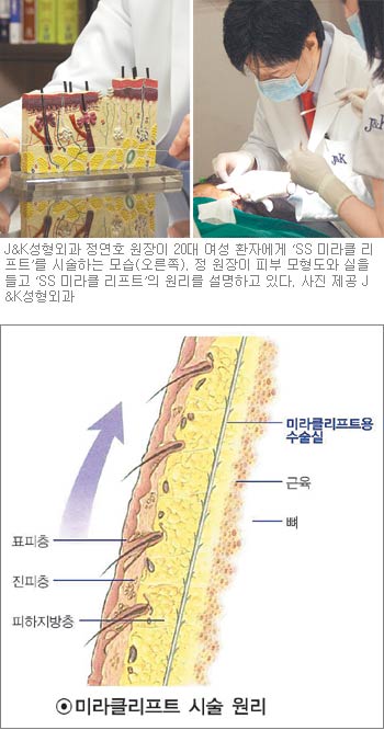 [Prime TOWN]안면리프팅，실이 얼굴에 기적을 줘요
