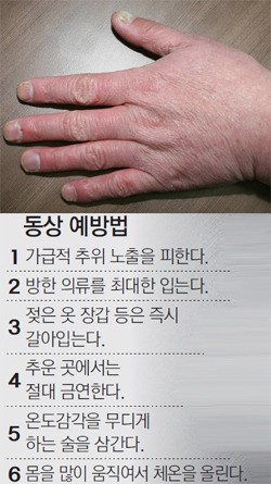 동창… 영상의 습한 추위에 피부질환, 동상… 영하의 추운 날씨에 손발 얼어