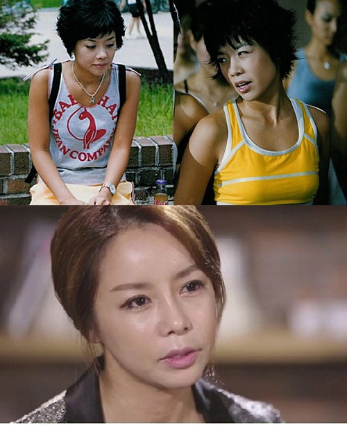 신이 양악수술 후 근황 고백 “3년간 슬럼프”…성형 전 모습 어땠나?