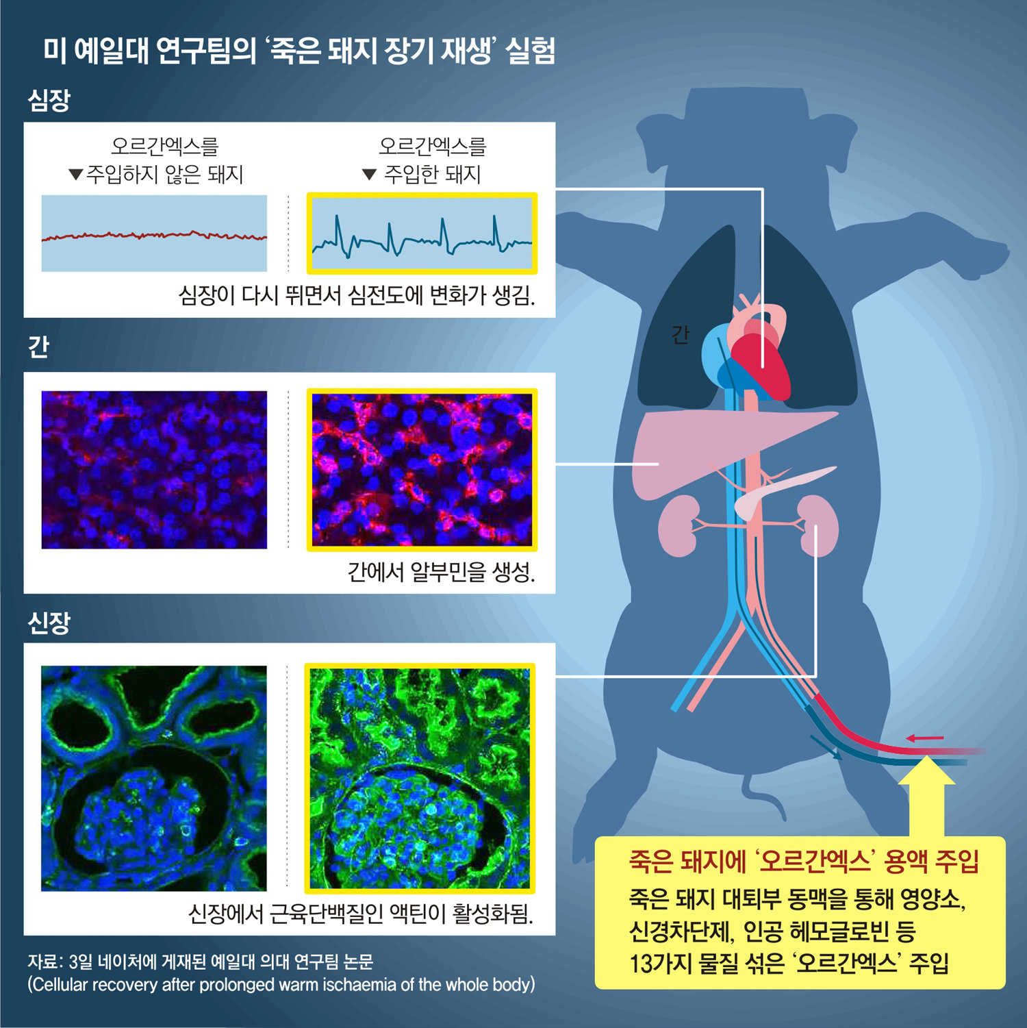 1시간 전 죽은 돼지 심장 다시 뛰게 했다