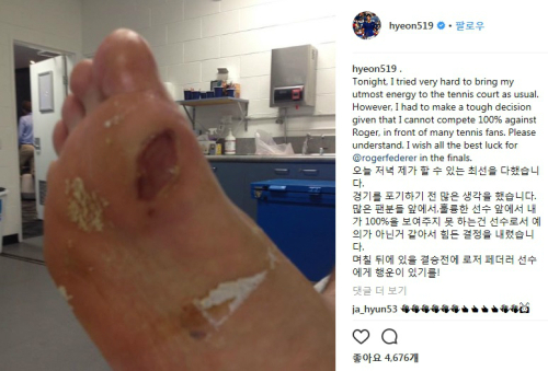 정현, 물집 제거로 생살 나온 오른 발바닥 공개 최선 다했고, 힘든 결정 내렸다
