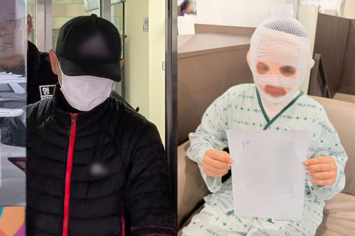 태국인 아내 얼굴에 끓는물 붓고선 “실수”…40대男 결국 구속