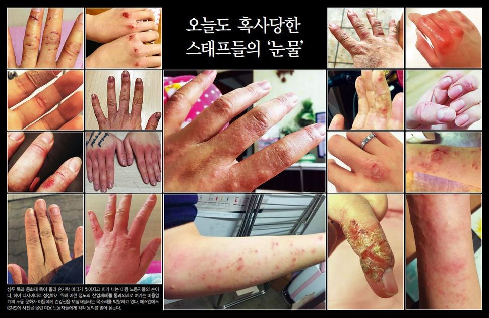  독 오른 손 치유할 미용노조 싸움…“걸리면 청담동 떠야” 