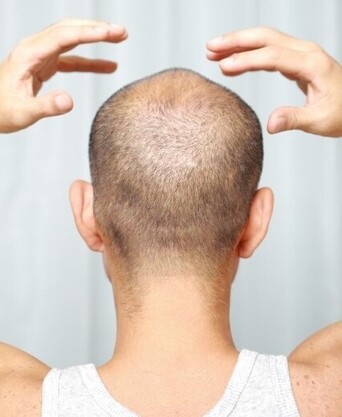 맥주 효모가 머리숱 비결?…소비자원 “허위 광고”