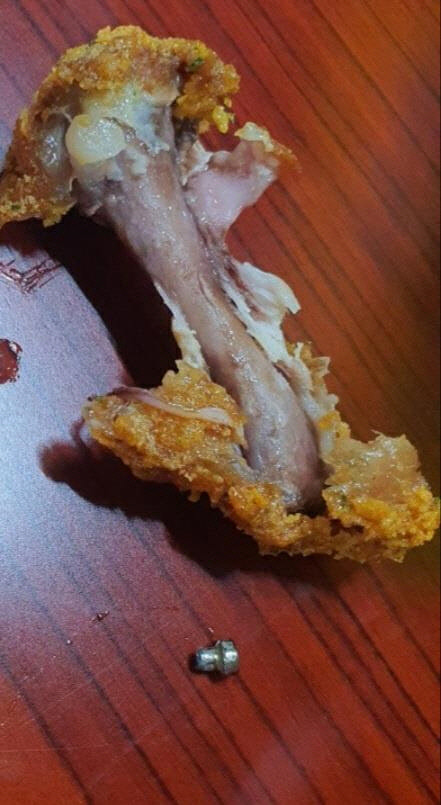 나사가 거기서 왜 나와? 치킨 먹다 아이 잇몸에 박혀…생니 두개 뽑았다