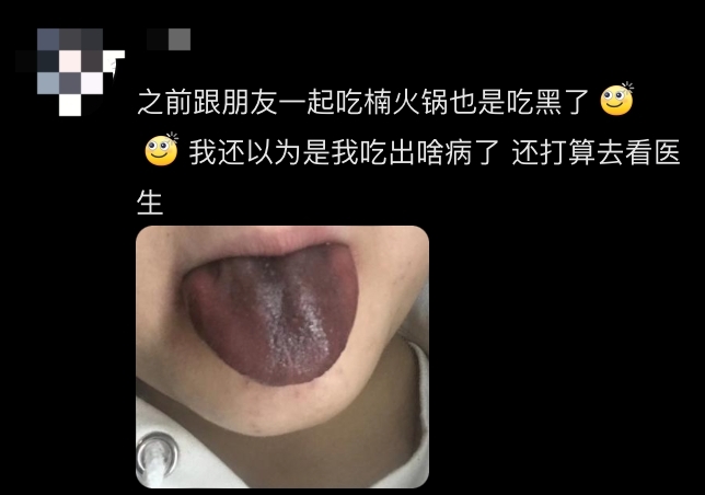 “훠궈 먹고 혀가 까맣게”…현지인도 경악한 中 식당 위생