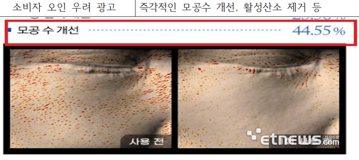 온라인에 넘치는 마이크로니들 화장품 허위·과대 광고 적발