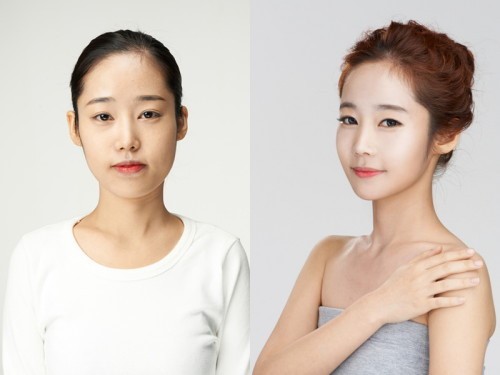 좋은 인상 만들려면? 모나지 않은 얼굴선이 기본