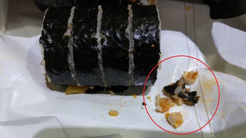 편의점 김밥 속 어금니는 치아 충전재…뜨거워진 진실 공방