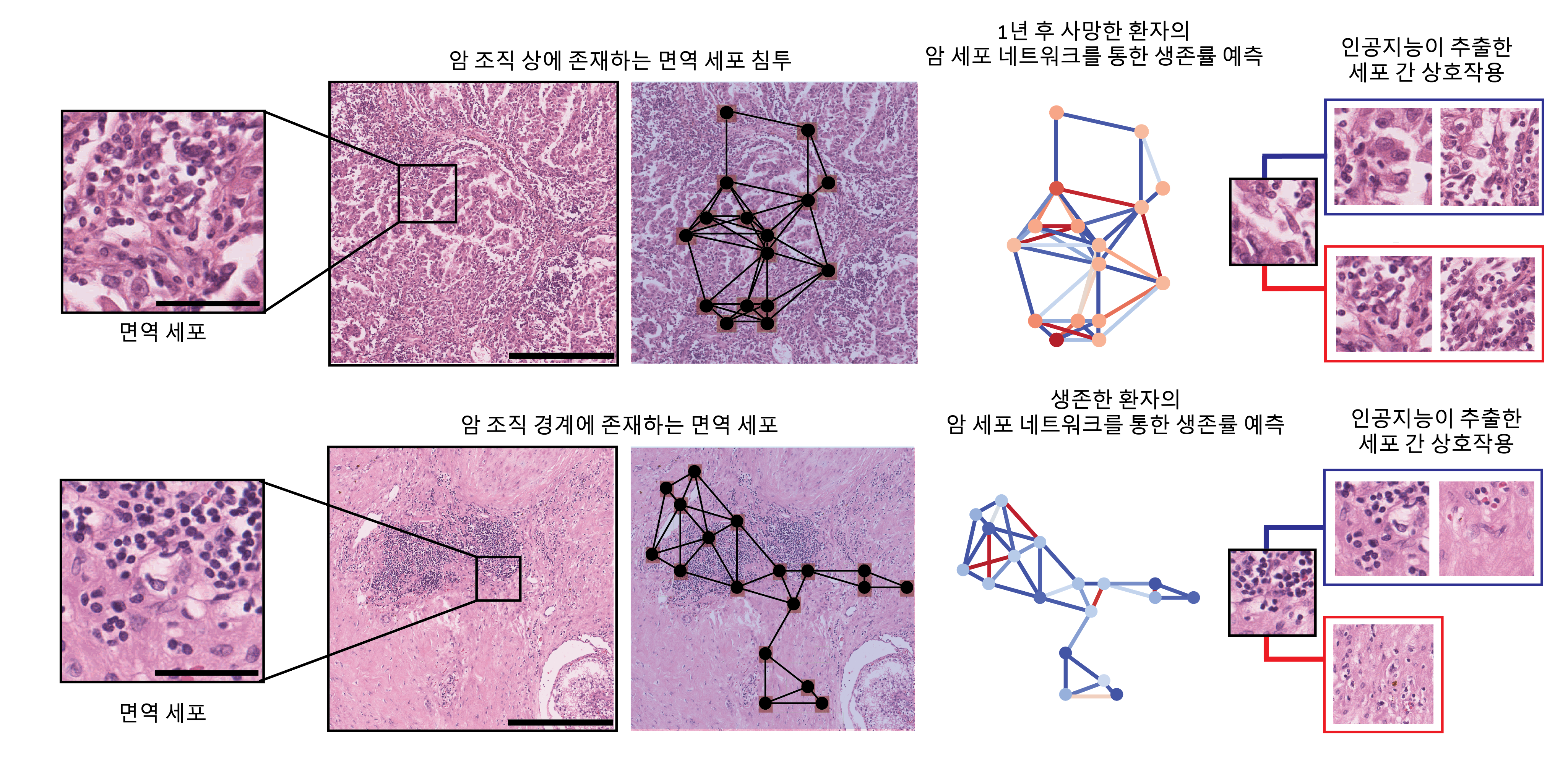 암 환자, 얼마나 살까?…인공지능이 예측한다