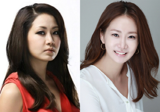 배우 신은경, 양악수술 전후 사진 공개 와, 사람이 달라보이네