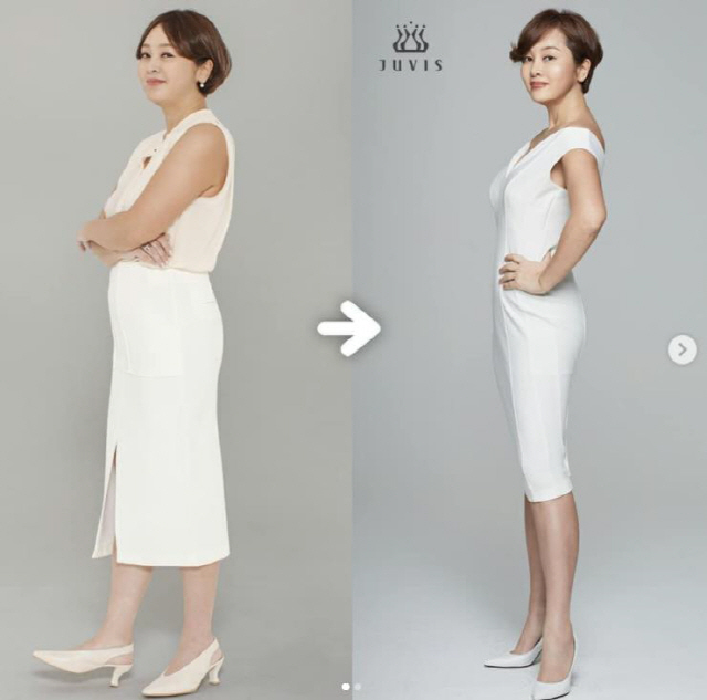 9kg 감량 이승연, 다이어트 대성공…갑상선기능저하증 부종 싹 사라져