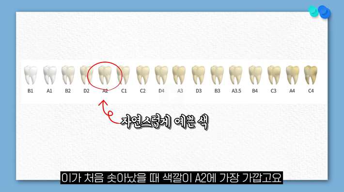 치과의사가 치아미백 절대 안 하는 이유![의사결정]