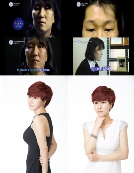 ‘충격 노안녀’ 문선영의 대변신, 렛미인4에 “내시간 되돌려 줘 감사”
