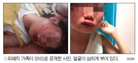 강릉에서도 10대 여학생들에 의한 폭행사건 발생.jpg | 인스티즈