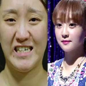 렛미인4 의부증 아내 김진, 다솜 닮은 꼴로 大변신!…세 아이 엄마 맞아?