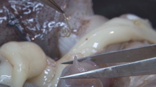 고래회충, 구충제로도 치료 불가? 내시경 통해서만 감염 여부 확인… 공포