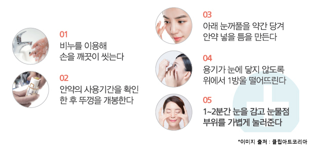 대구 누네안과병원 지역 최초 녹내장 젠(XEN) 마이크로 스텐트 삽입술 도입