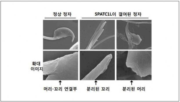 정자 머리-꼬리 연결하는 단백질 활동 밝혔다