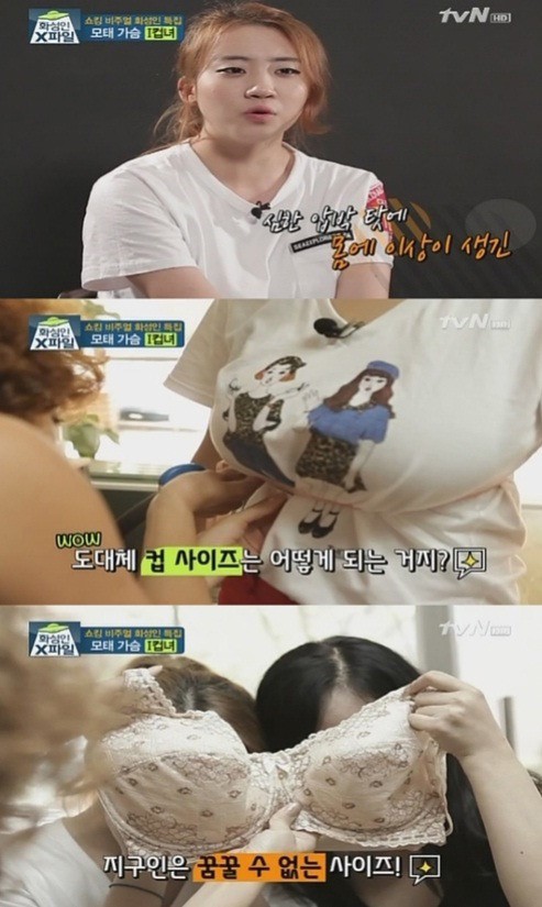 화성인 I컵녀, 무게를 못견뎌 허리통증까지…