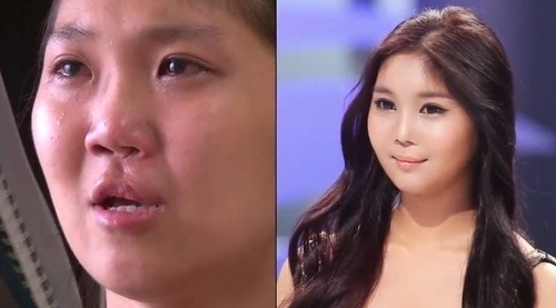 [뷰티]렛미인2, 닥터스들이 포기했던 두 얼굴 ‘외계인女’ 그녀는 현재?